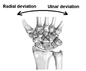 wrist deviation